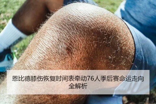 恩比德膝伤恢复时间表牵动76人季后赛命运走向全解析